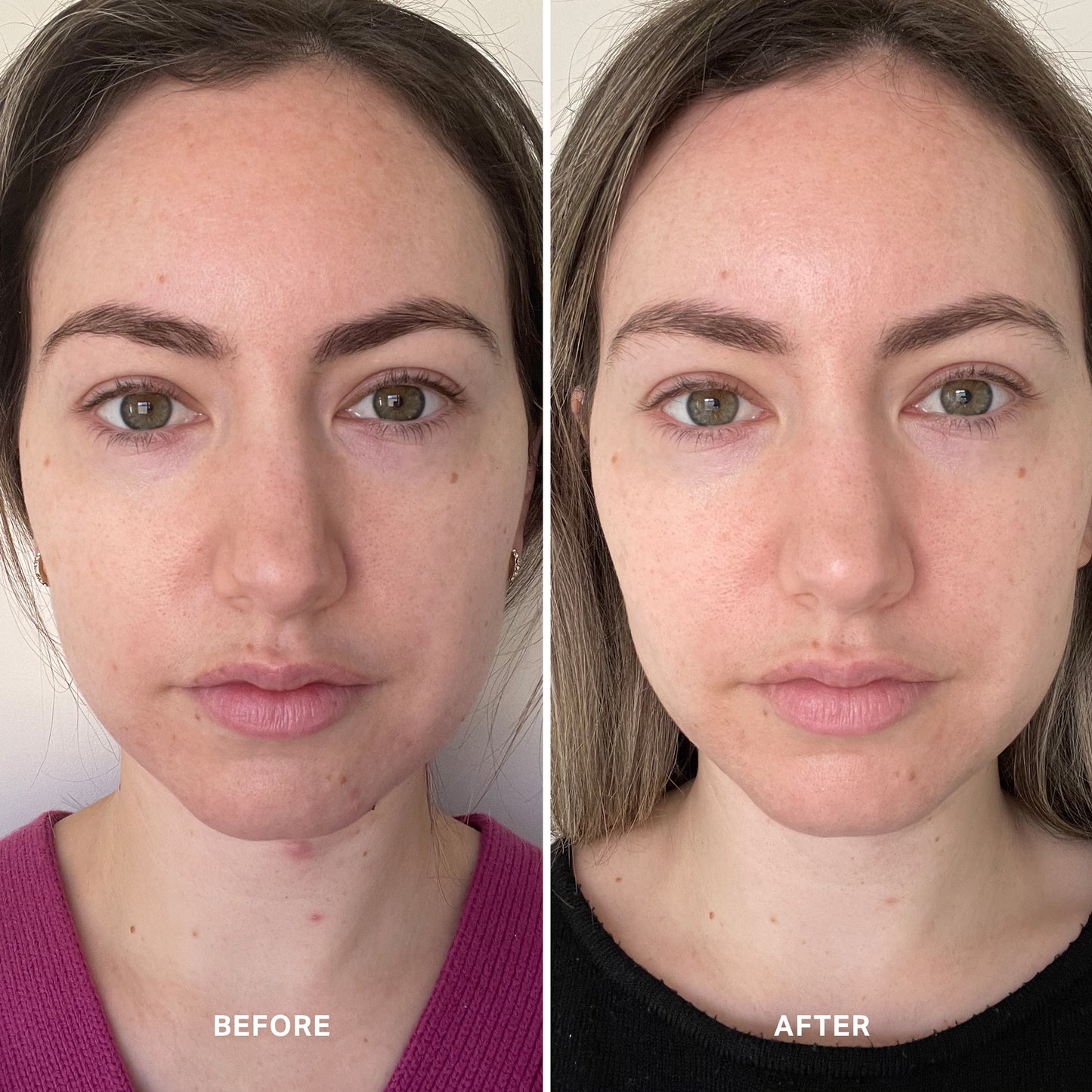 Vitamin B Serum with 5% Niacinamide