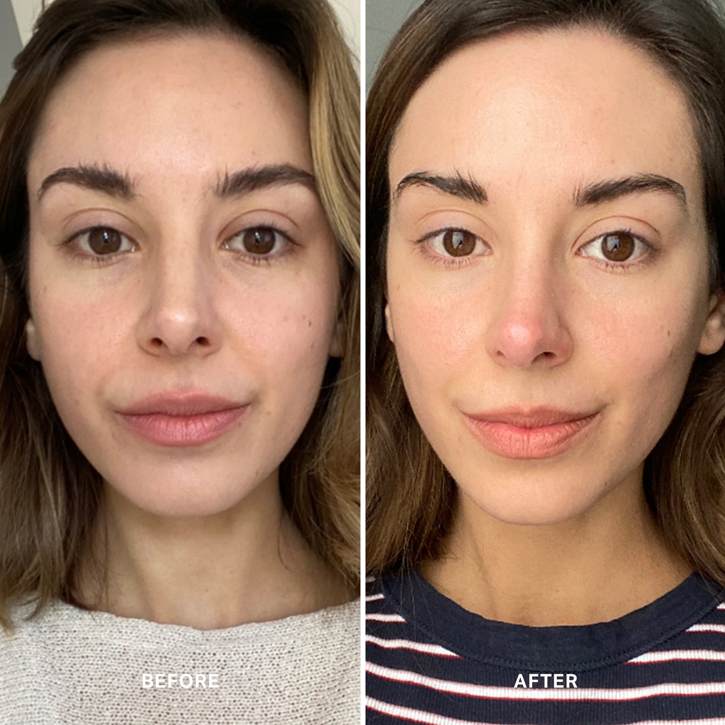 Vitamin C Serum with 10% Ethyl Ascorbic Acid