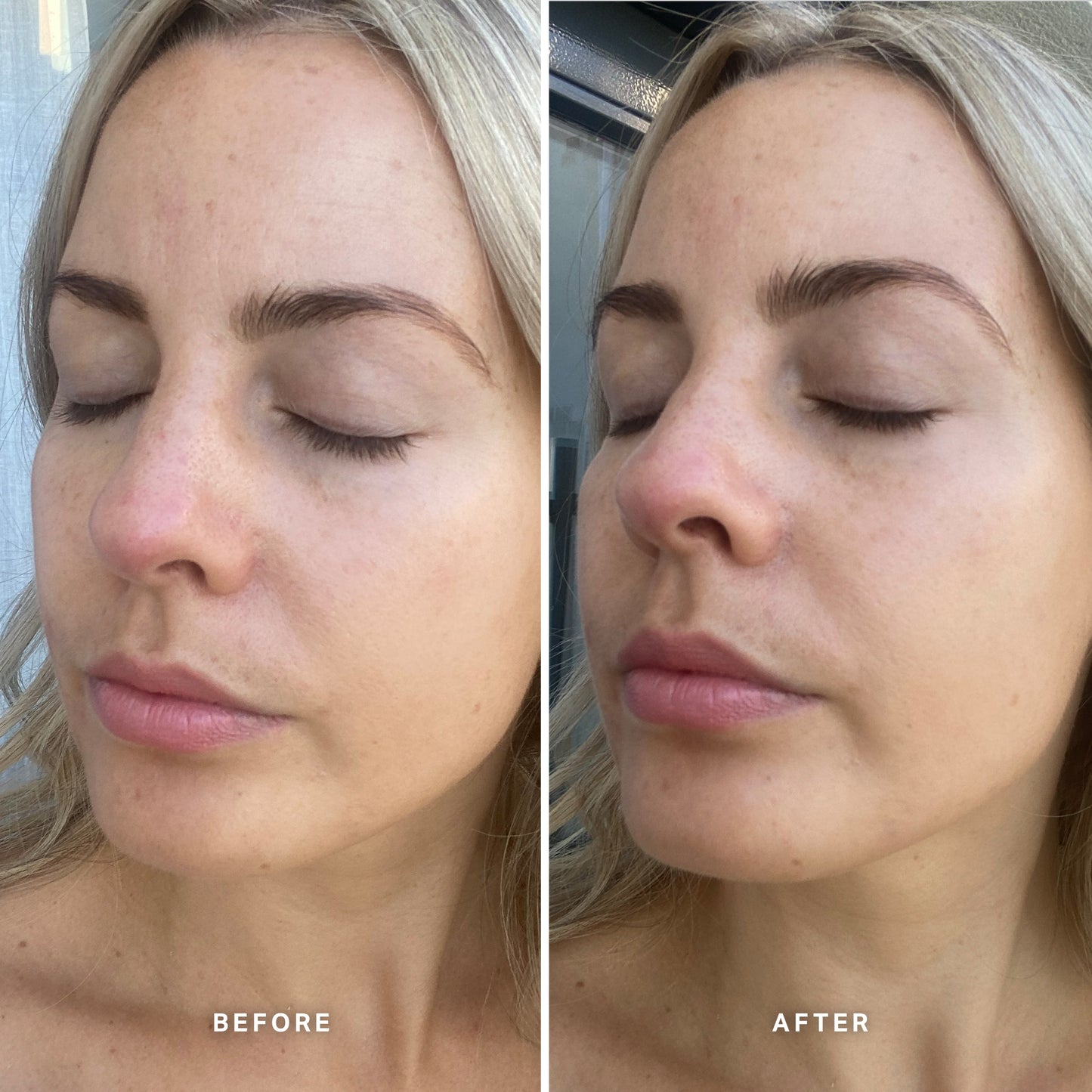 Vitamin E Serum with 1% Ceramide Complex